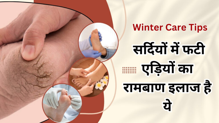 Winter Care Tips