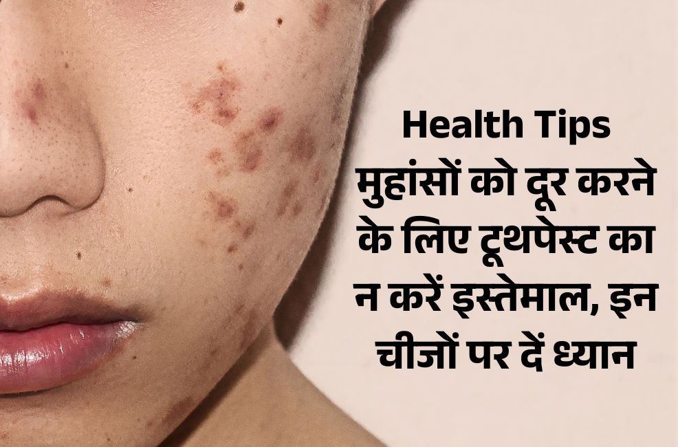 health tips for pimple